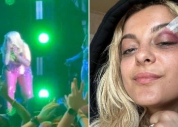 Bebe Rexha collapses after fan throws phone at her face, man arrested – National