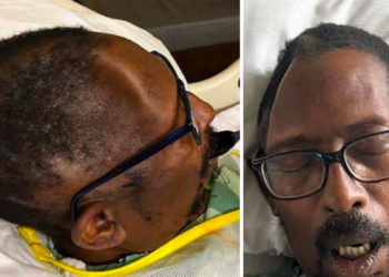Man Sues Hospital for Allegedly Losing Part of His Skull, Charging Him $19K to Replace It